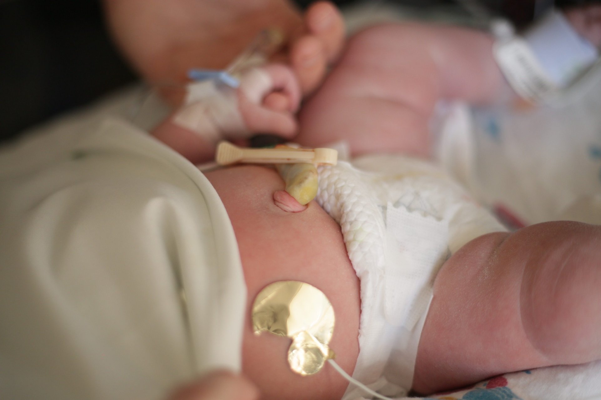 Close-up of newborn baby with NICU monitoring equipment